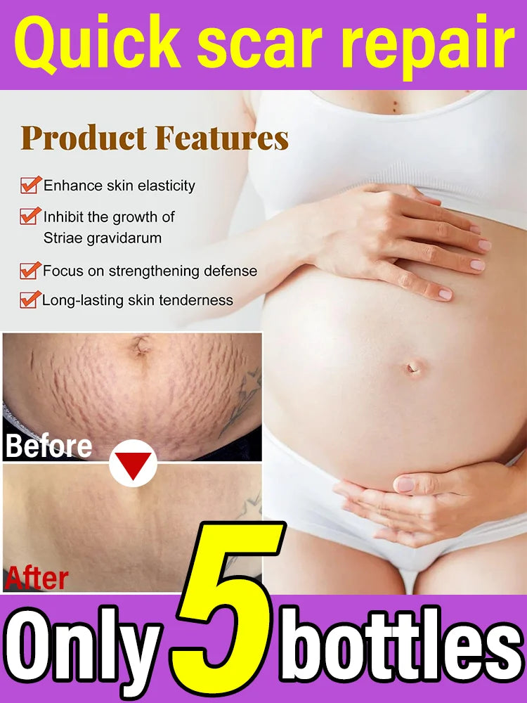 Body essential oil suitable for pregnant women, remove stretch marks, moisturize and soothe skin