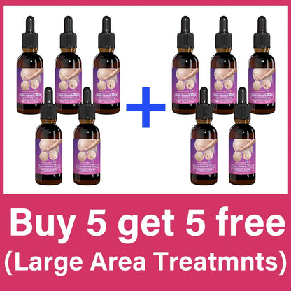 Body essential oil suitable for pregnant women, remove stretch marks, moisturize and soothe skin
