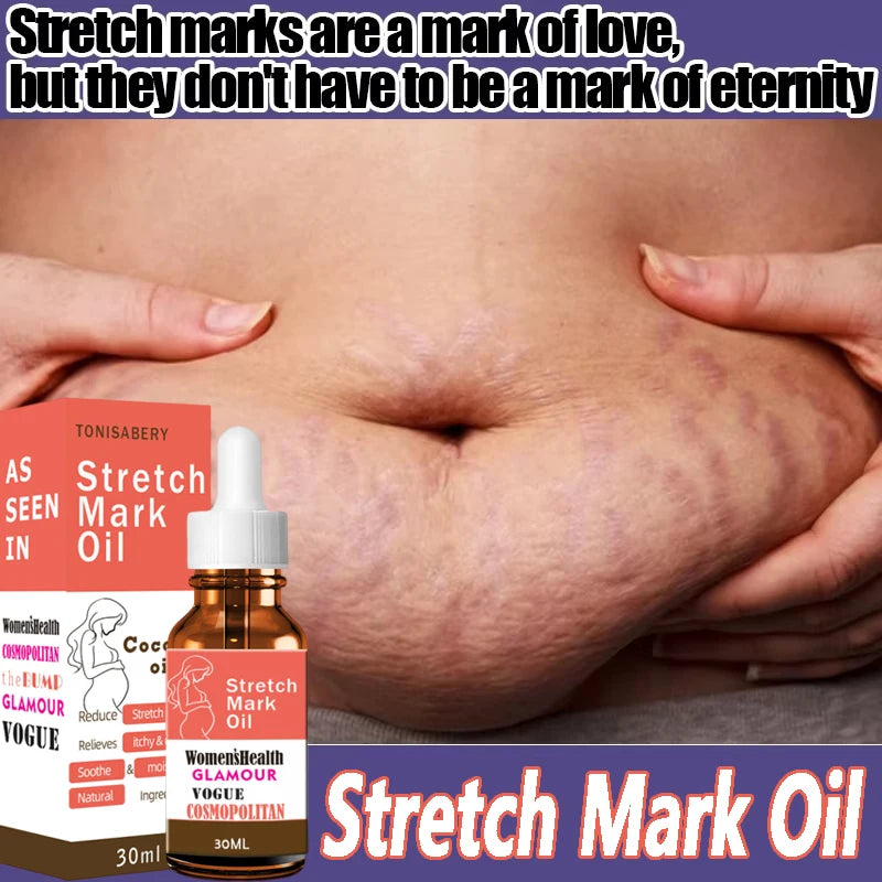 Stretch Marks Oil Maternity Pregnant Women Pregnancy Anti-Winkle Smooth Repair