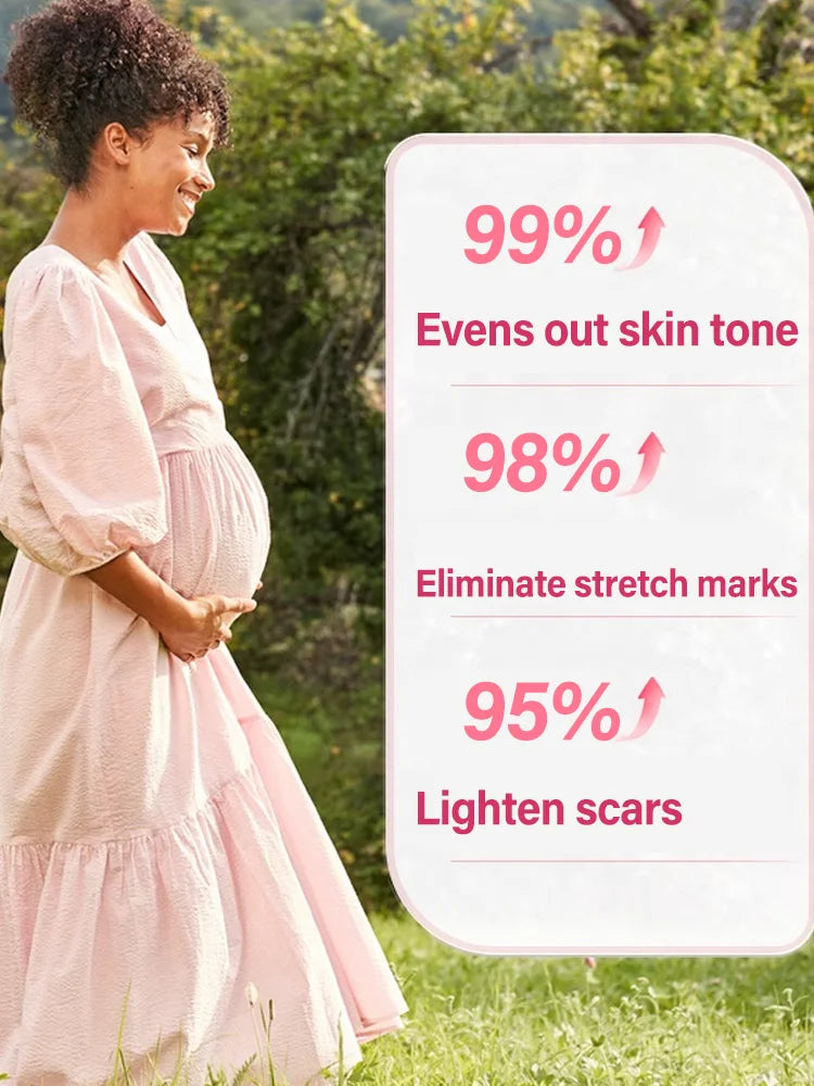 Body essential oil suitable for pregnant women, remove stretch marks, moisturize and soothe skin