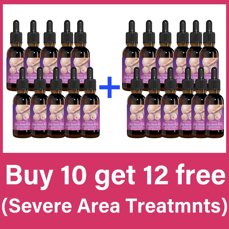 Body essential oil suitable for pregnant women, remove stretch marks, moisturize and soothe skin