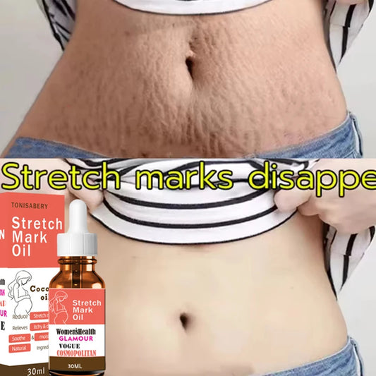 Stretch Marks Oil Maternity Pregnant Women Pregnancy Anti-Winkle Smooth Repair